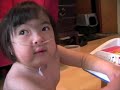 Mieko plays piano, Trisomy 18