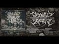 Apotemnophilia Video preview