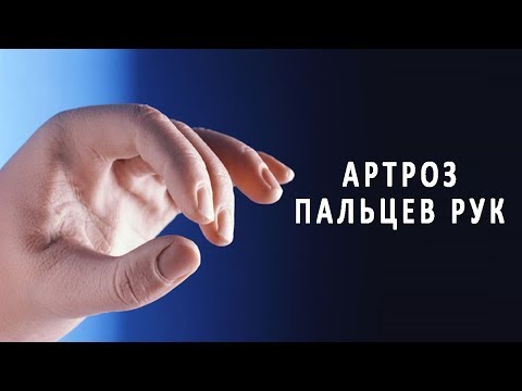 Смотреть Что делать, если болят суставы пальцев рук: причины и лечение видео Смотреть Что делать, если болят суставы пальцев рук: причины и лечение видео