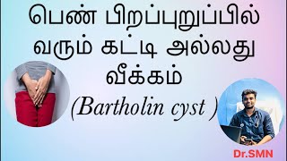 Bartholin cyst in Tamil #vaginalinfection #cyst #swelling #abscess #pain #doctor