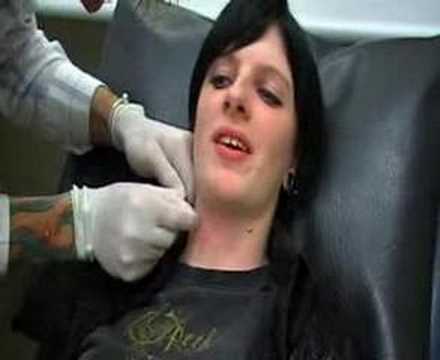 Piercing micro dermal implant by Joff.