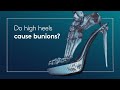 Do high heels cause bunions?