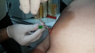 Göğüs - Piercing