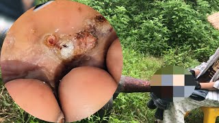 Shocking Jigger Infestation Extreme Dirty Foot Asmr Relaxing Deep Cleaning