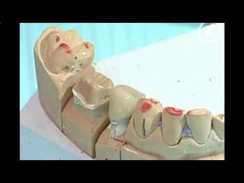 Чем снять острую зубную боль в домашних условиях Чем снять острую зубную боль в домашних условиях