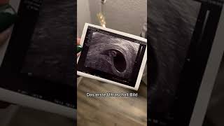 Trend Für Schwangere Mamis Cecelicious
