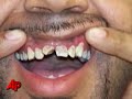 Jailer Allegedly Rips Out Inmates Gold 'grill'