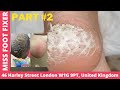 satisfying cracked heel removal - worst cracked heels removal by miss foot fixer