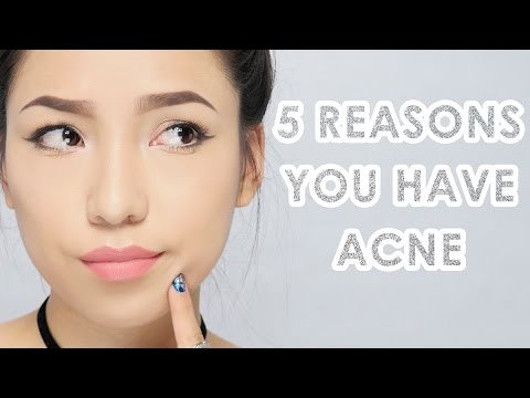 5 Reasons You have Acne & How To Get Rid Of Them - YouTube