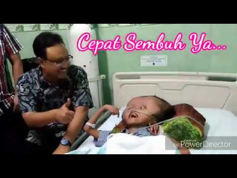 Gus Ipul Kunjungi Bocah Penderita Hidrosefalus. Gus Ipul Kunjungi Bocah Penderita Hidrosefalus. #1