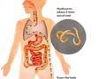 Top 10 Weirdest Diseases default Top 10 Weirdest Diseases