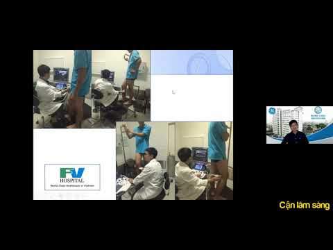 QUY TRÌNH SIÊU ÂM TĨNH MẠCH CHI DƯỚI Bs NGUYỄN QUANG TRỌNG
