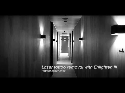 Laser Tattoo Removal with the Cutera enlighten III - Aesthetic Harmony
