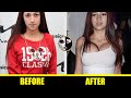 Bhad Bhabie Plastic Surgery Before and After (Nose Job | Boob Job | Bum Filler) - Plastic Surgery TV