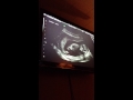Ani's Ultrasound 4-8-13