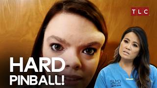A Patient Grew Her Own Pinball - Dr Pimple Popper Tlc