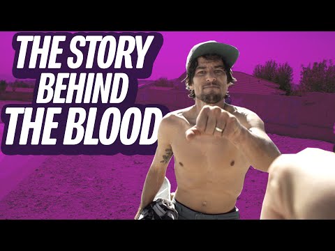 A Closer Look: EMAN's Bloodiest Battle! Screaming Vlog 81 | Santa Cruz Skateboards