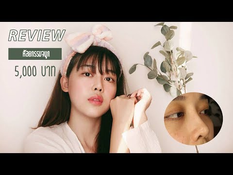 Review | รีวิว ทำจมูก กับหมอบุญถิ่น แค่ 5,000 บาท