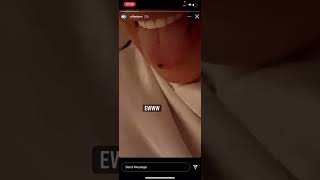 Cardi B Eating Offset Scab Off His Skin