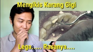 Reaksi Melihat Karang Gigi Terbesar Reaksi Melihat Karang Gigi Terbesar