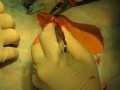 labia