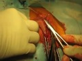 labia