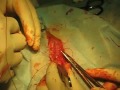 labia