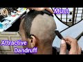 Most Attractive😱Dandruff Remove head shave Tutorial for young boy 2024💫Bald HeadShave