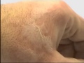 Соляная кислота если попала на кожу Соляная кислота если попала на кожу