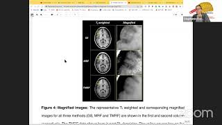 Neuroccino 26th September 2022 - Rapid imaging