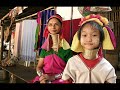 Confirmation That Elongated Conehead Skulls From Peru And Elsewhere Are images Confirmation That Elongated Conehead Skulls From Peru And Elsewhere Are