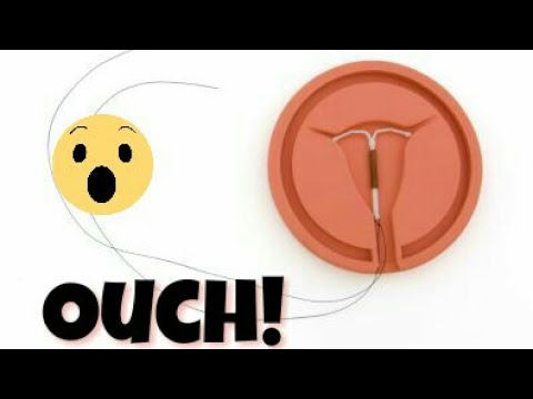Could an IUD Be Right for You images Could an IUD Be Right for You pictures