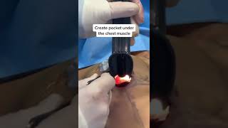 15 Second Chest Enlargement