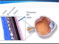 TEDxUWollongong - Professor Rob Shepherd on the Bionic Eye prototype