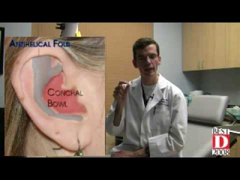 Otoplastyka, chirurgia plastyczna uszu