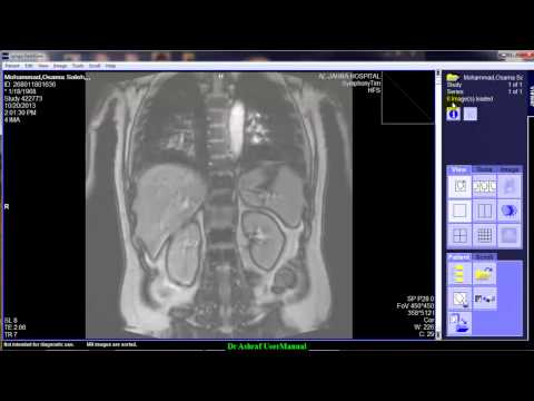 Syngo fastview инструкция на русском — 2 ответа Syngo fastview инструкция на русском — 2 ответа