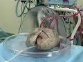 Human Lungs Breathe on Life Support (Creepy)