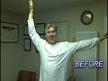 Shoulder Exercise