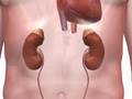 Effects of High Blood Pressure on your Body - KreativeVistas