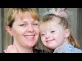 Down's syndrome