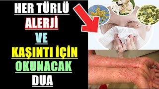 Her Türlü Alerji̇ Ve Kaşinti İçi̇n Okunacak Dua