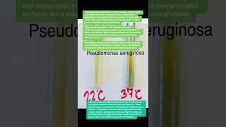 Pseudomonas Aeruginosa Is A Harmful Bacterium That Can Cause Serious Infections