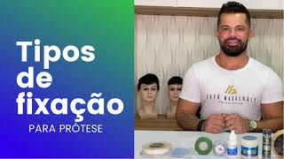 TIPOS DE FIXAÇÃO PARA PRÓTESE CAPILAR