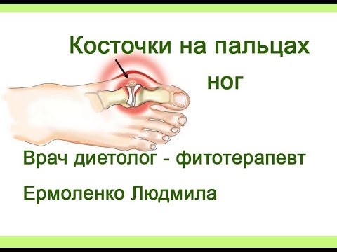Актовегин, винпоцетин, кавинтон, эуфиллин, трентал ArtOfWar. Миронов Вячеслав Николаевич. Я был на этой войне