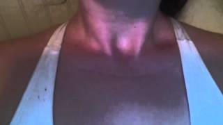 Hiccups 19