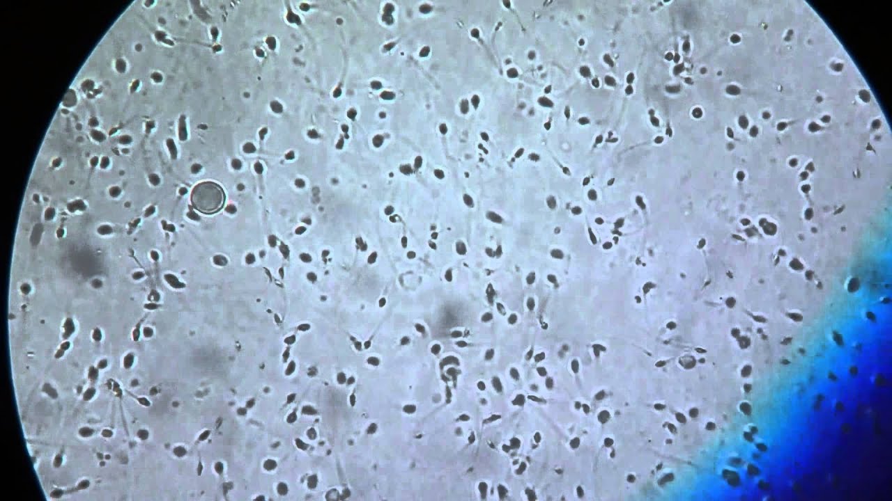 Секс Под Микроскопом