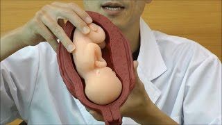 子宮と胎児，5段階セット，ソフトモデル：動画