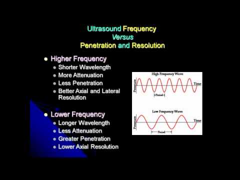 How Ultrasound Imaging Works YouTube