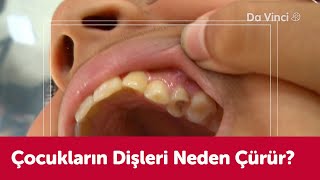 Çocuklarda Diş Sorunu🦷 | Görevimiz: İnsan Vücudu | Da Vinci TV Türkiye