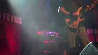 Watch Dying Fetus Intentional Manslaughter video